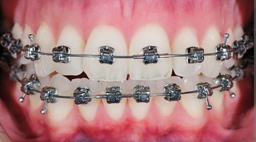 After treatment - Patient 1